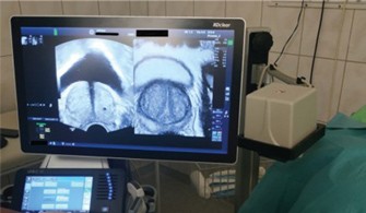 MR-fúziós ultrahangvezérelt prosztatabiopszia a Péterfy Kórházban